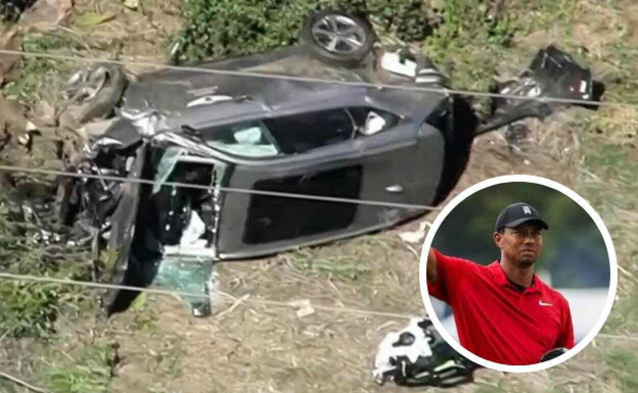 Tiger Woods se somete a cirugía tras sufrir múltiples lesiones en las piernas por accidente automovilístico