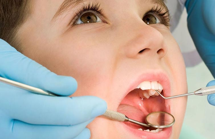 Recomienda Secretaría de Salud mantener buena salud bucal para prevenir la caries