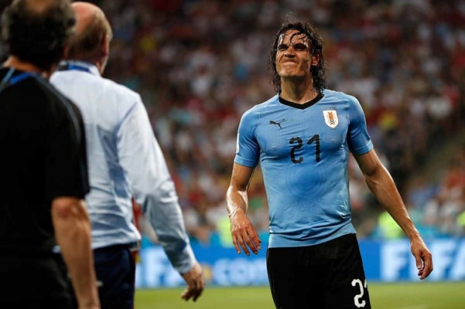 Cavani no jugará contra Francia por lesión