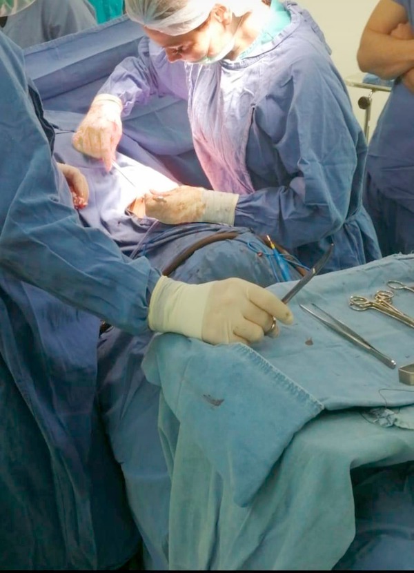 Realizan primera cirugía cardiovascular en el Hospital General de Nogales