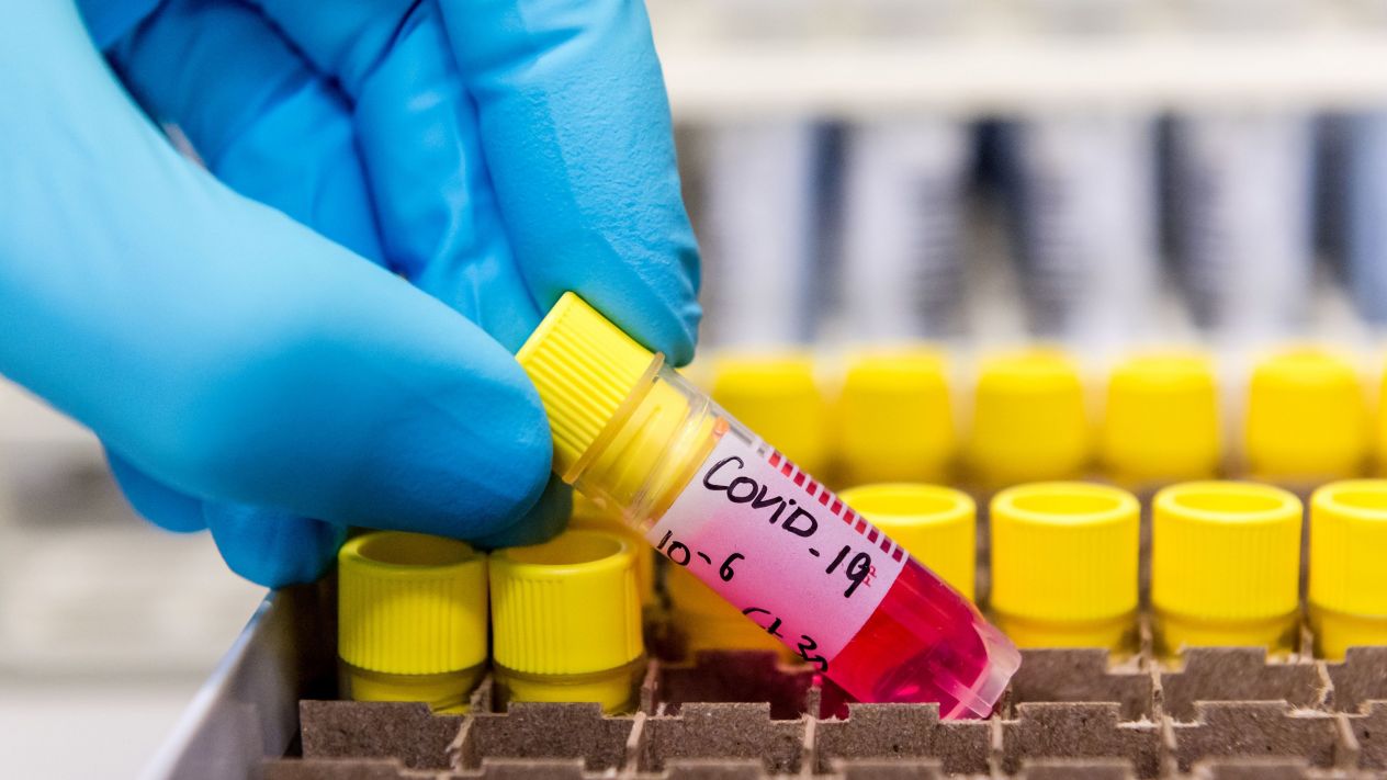 Encuentran el coronavirus 2.0 y es 10 veces más contagioso