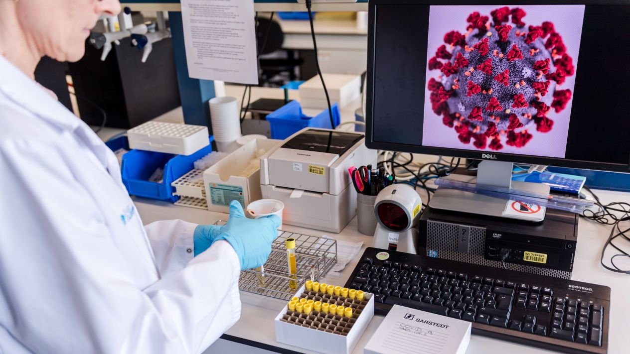 Detectan caso de reinfección por COVID-19 en Bélgica; es el segundo a nivel mundial Detectan caso de reinfección por COVID-19 en Bélgica; es el segundo a nivel mundial