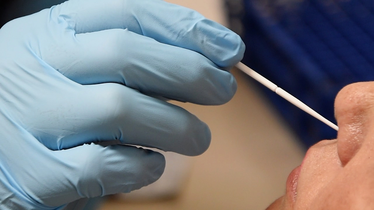 Logra Isssteson tener diagnóstico de COVID-19 en menos de 20 minutos