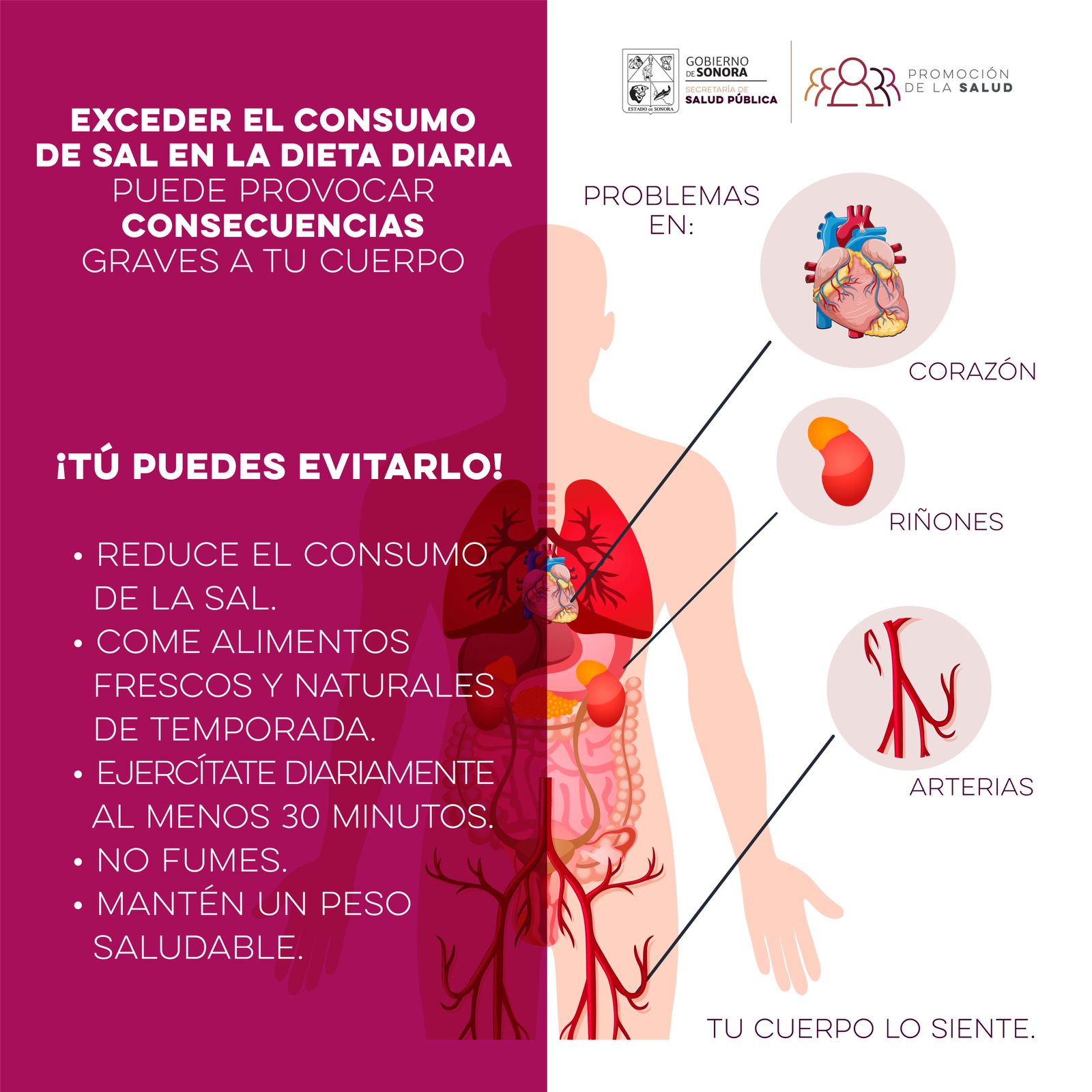 La Secretaría de Salud recomienda una alimentación sana y evitar el consumo excesivo de sal