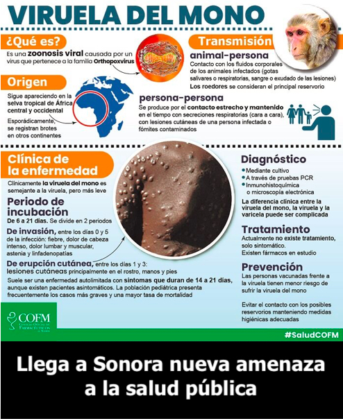 Viruela