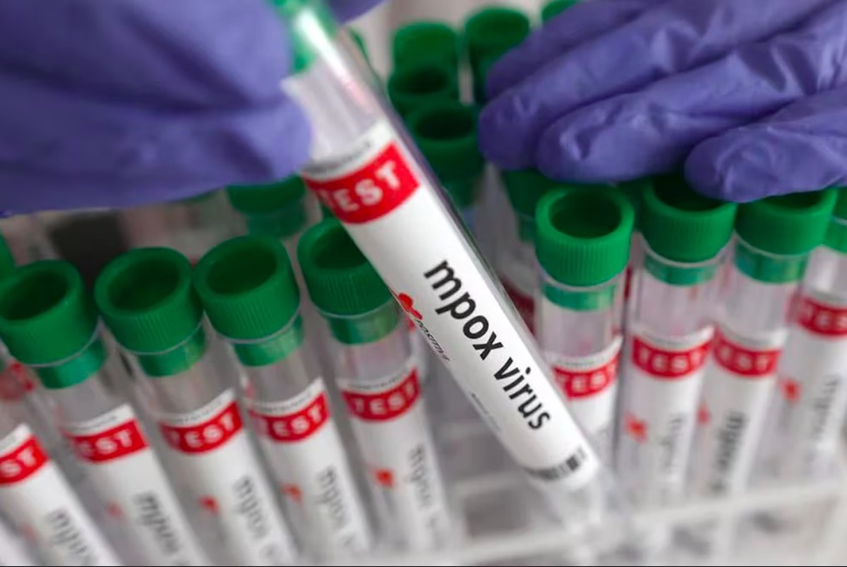 Confirman  dos casos importados de Mpox en el estado